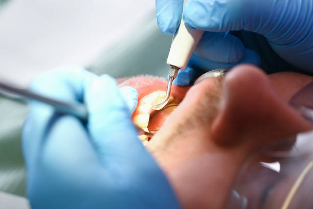 Best Cosmetic Emergency Dentistry in Paducah, KY