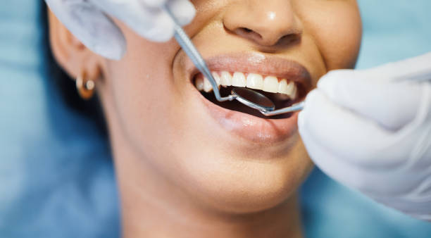 Best Emergency Tooth Extraction in Paducah, KY